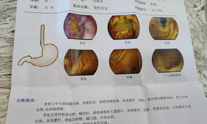 松狮胃病的全面治疗（宠物狗也需要胃肠保健）