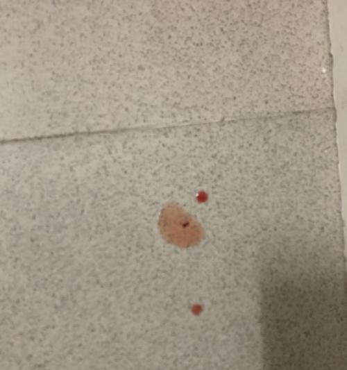 猫咪尿血的原因及应对方法（解决猫咪舔弟弟尿血的困扰）