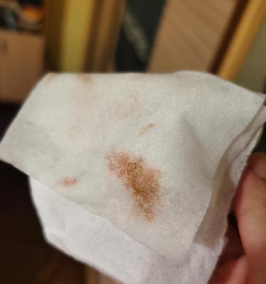 小猫拉褐色稀屎的原因及应对方法（宠物健康问题的关注与处理）