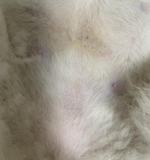 腹部黑斑的成因及治疗方法（探究腹部出现黑斑的原因以及有效治疗方法）