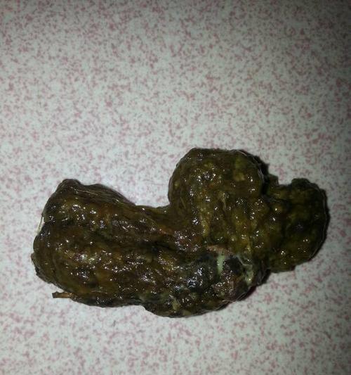 骨骼细小的营养大计——吃什么好？（骨骼健康从餐桌开始，细节中寻找关键）