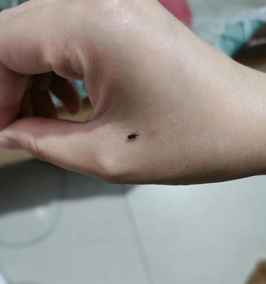 狗狗长跳蚤是怎样的？（探究狗狗身上跳蚤的特征及预防方法）