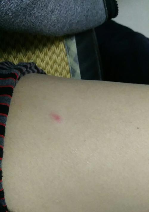 身上长红包，原因究竟是什么？（探寻长红包现象的原因和背后的意义）