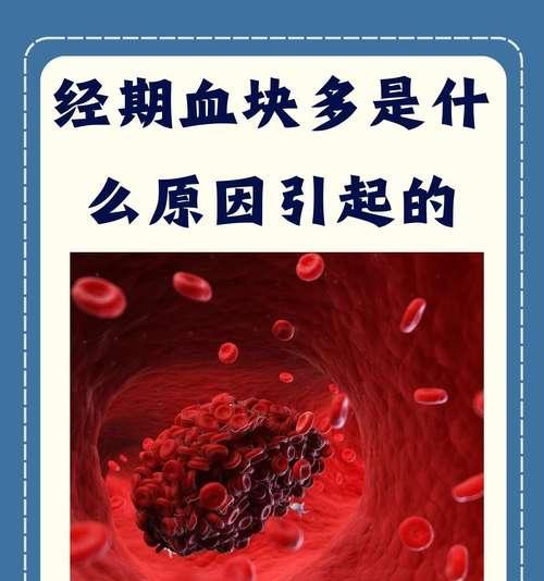 拉血块的原因及相关信息（了解为什么会产生拉血块的原因以及其相关影响）