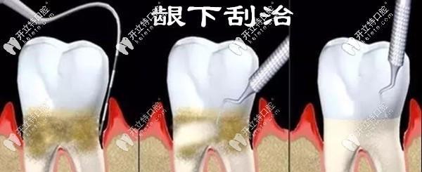 贵宾犬为何易患牙结石？（探究贵宾犬易患牙结石的原因及预防方法）