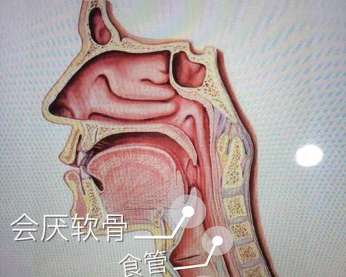 咽喉卡出像面球的原因及解决办法（探究咽喉卡出像面球的原因以及有效的解决方法）