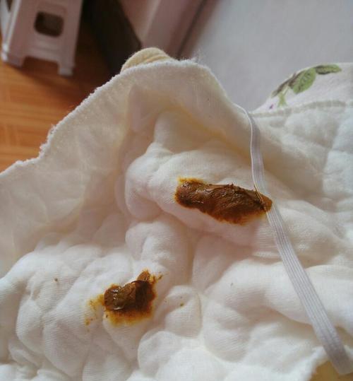 拉粑粑好臭是什么原因？（探究拉粑粑臭的成因和解决方法）