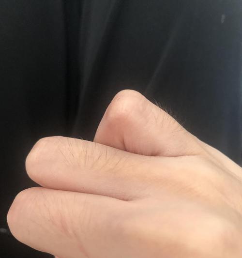 身上毛越来越长的原因及解决方法（探索身体毛发增长的根源，打造光滑肌肤的秘诀）