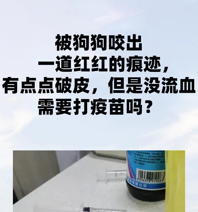 狗咬打针有效时间究竟有多久？（解析狗咬后打针的有效期限及关键因素）