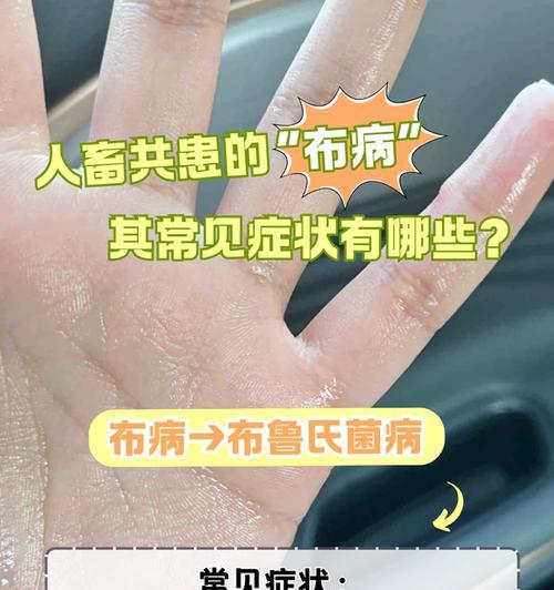 揭秘狗传染病（保护爱宠免受病痛折磨，了解狗传染病早预防）